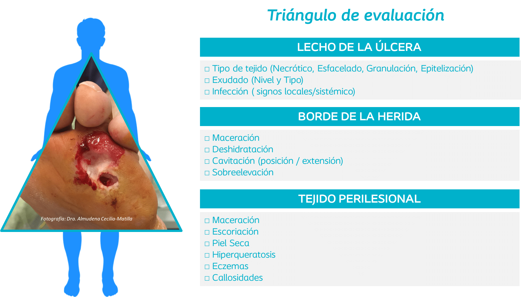 Úlceras de pie diabético - Triángulo de evaluación