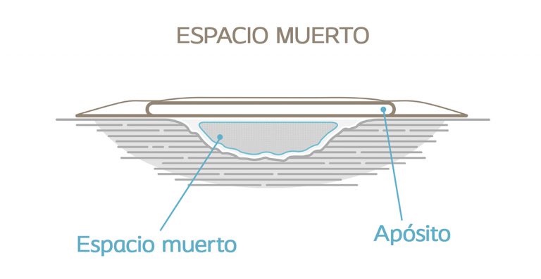 espacio muerto en la cicatrizacion de herida