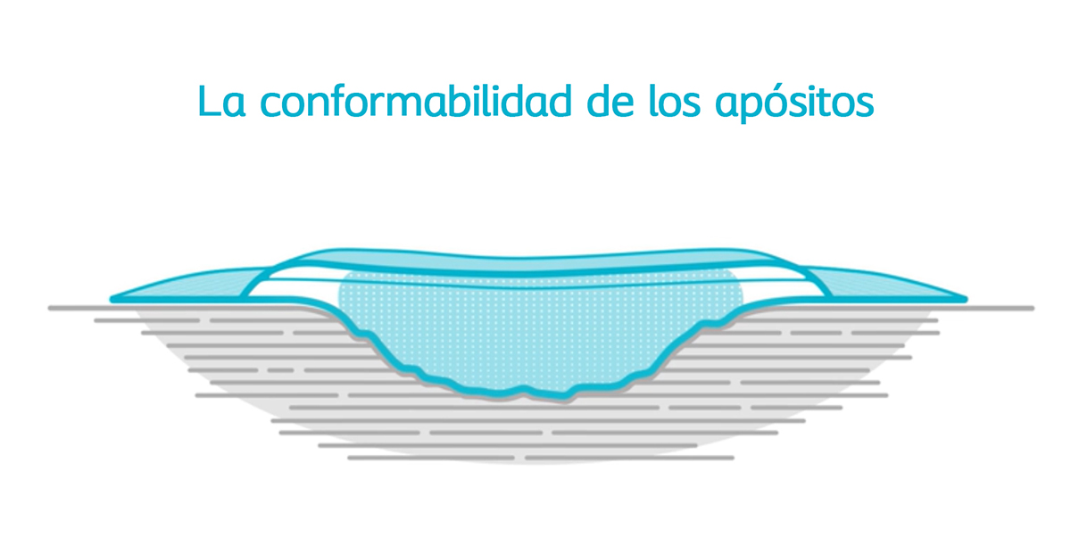 conformabilidad de apositos